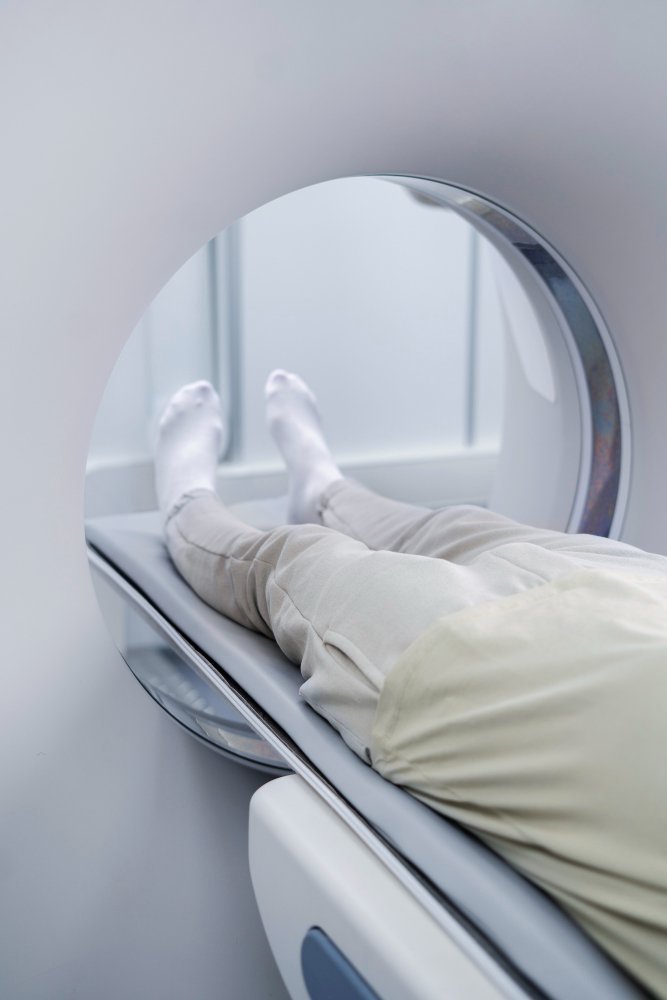 A detailed medical imaging scene of a patient undergoing an MRI (magnetic resonance imaging) procedure. In the foreground, a person lies on an examination table, wearing a hospital gown and earplugs, with their head carefully positioned within the circular MRI machine. Surrounding the table are various medical equipment and monitoring devices, creating a sense of a professional, clinical environment. The middle ground features hospital staff, including a technician operating the MRI controls and a doctor reviewing the scan results on a nearby computer screen. In the background, the walls of the well-lit, modern MRI suite are visible, conveying a sense of sterility and advanced medical technology. The overall scene evokes a calm, precise, and authoritative atmosphere associated with the MRI imaging process.