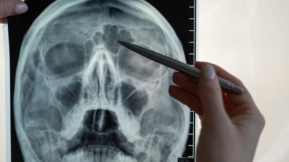 Biopsies guidées par imagerie : comment ça se passe au Centre de Radiologie Diouri ?