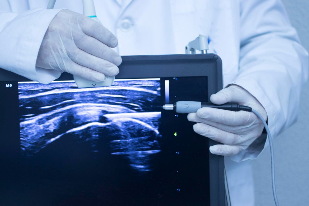 Biopsies guidées par imagerie : comment ça se passe au Centre de Radiologie Diouri ?