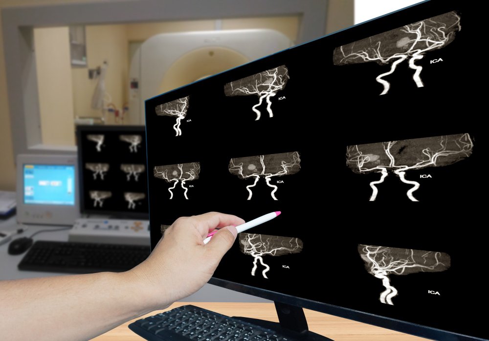 Biopsies guidées par imagerie : comment ça se passe au Centre de Radiologie Diouri ?